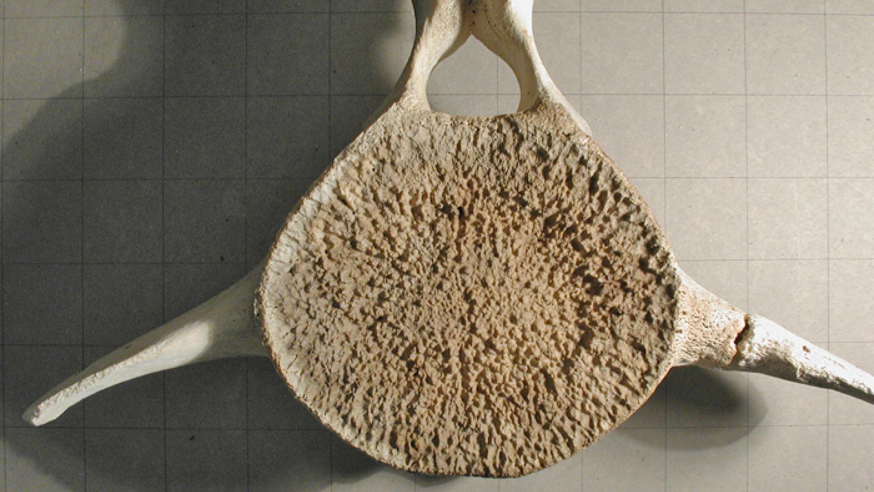 The relief of the disc and the recesses of the vertebrae fit perfectly together.
