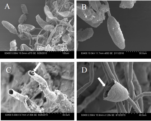 Scanning electron microscope images of many root hair tip galls