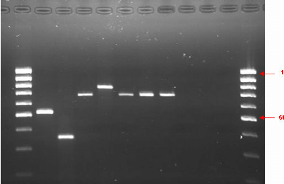 agarose-gel-electrophoresis-2-of-pcr-product-of-di.png