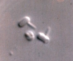 medium_lab1.jpg Predatory Bdellovibrio (smaller cells) attacking E. coli pre