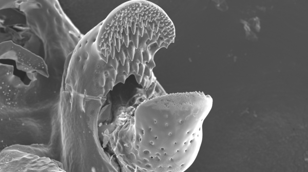 Scanning Electron Micrograph of Pedicellaria – Judge's Choice 2014