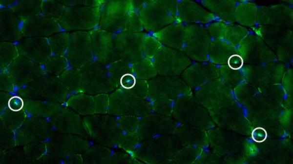Satellite cell identification using immunofluorescence in mouse plantaris muscle.