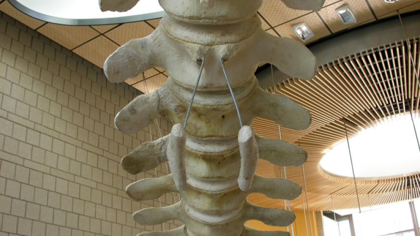 The pelvic girdle remnants held in place with threaded rods.